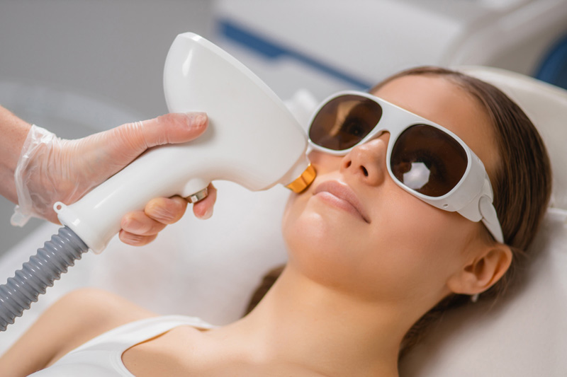 Laser Treatment